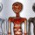 The Tridactyl Enigma: From Debunked Hoax to Anatomical Mystery